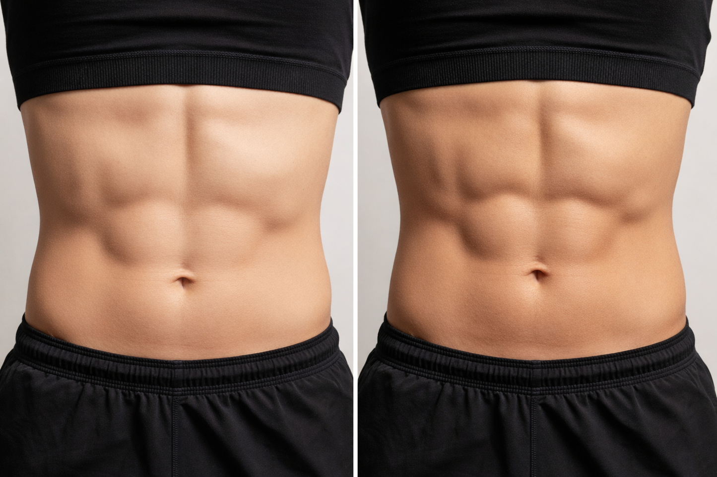 M Shape Treatments