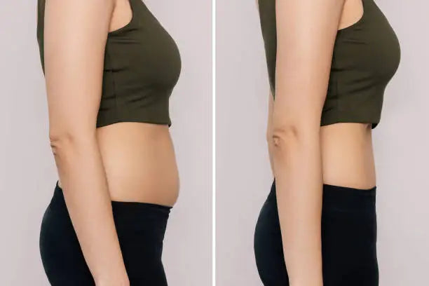 M Shape Treatments